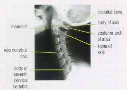 Figure2a